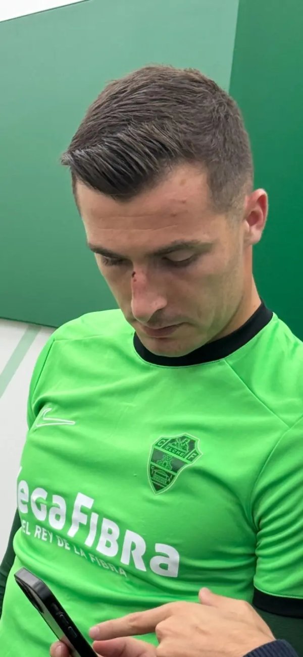 VAR can thiệp, không phạm lỗi! Peña và Vinicius va chạm và bị hòa, để lại vết sẹo trên sống mũi sau trận đấu